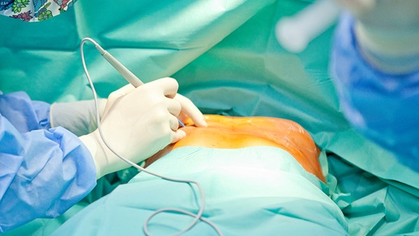 傳統(tǒng)痔瘡手術(shù)一定會(huì)狹窄嗎