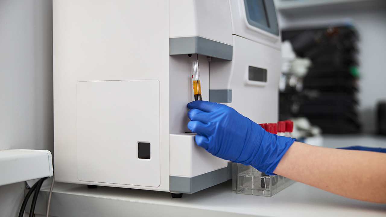 b超能發(fā)現(xiàn)腎結(jié)核嗎？