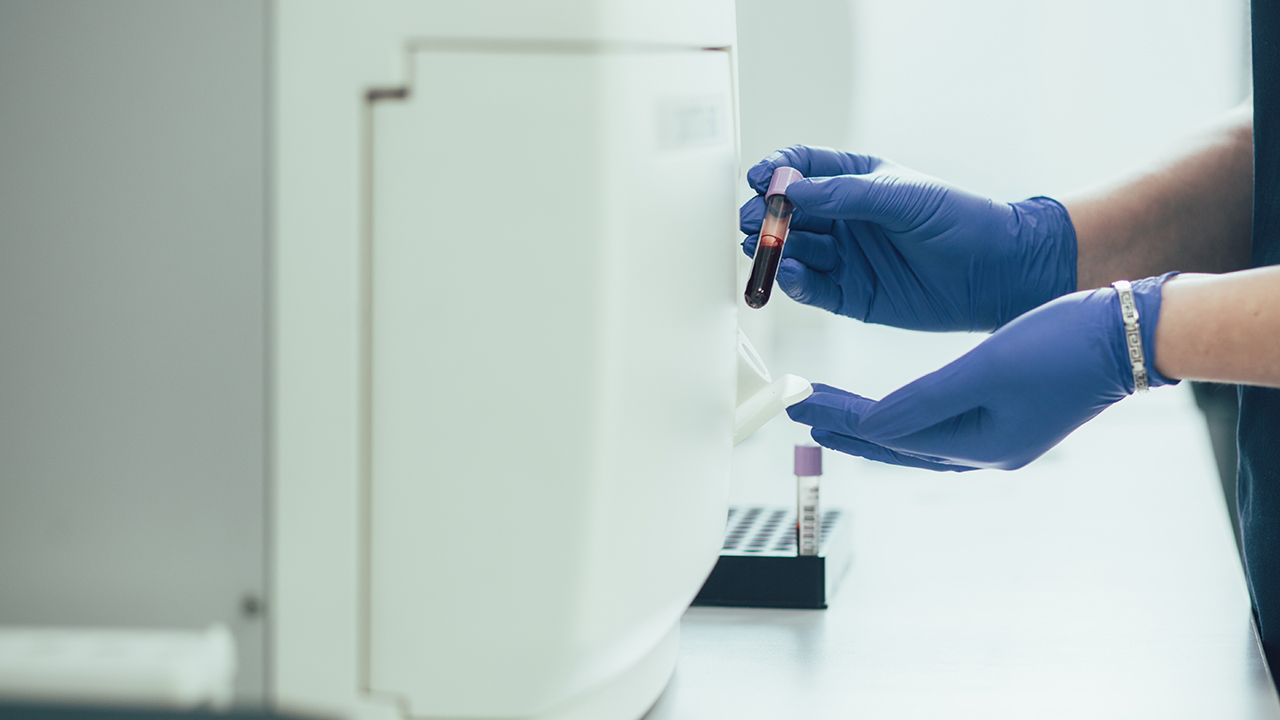 哺乳期小腹痛怎么了？