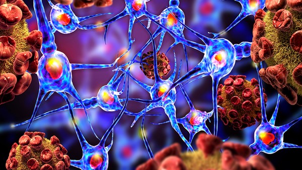 成人癲癇病的治療方法