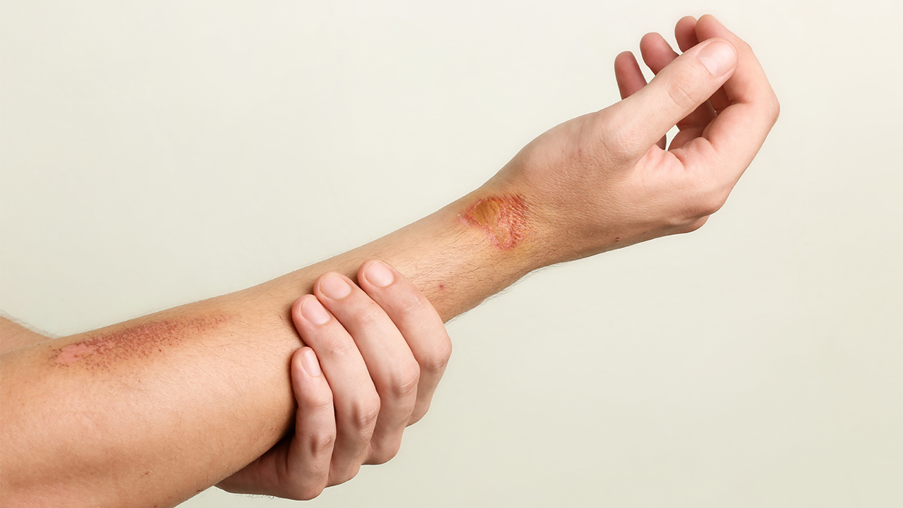 尺神經(jīng)損傷有哪些癥狀