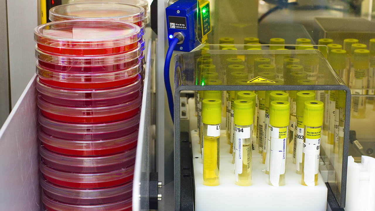 怎么判斷耳朵淋巴癌