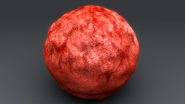 從病魔手中搶回生命——記疫情下成功救治1例破裂髂動(dòng)脈瘤患者