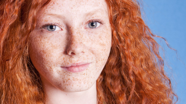 吃肺結(jié)核藥怎么避免變黑