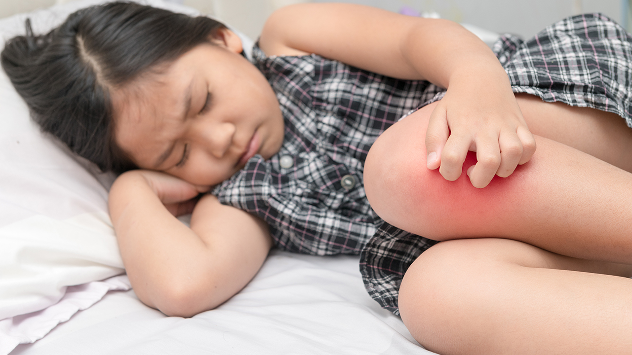 血清怎樣判斷類風濕