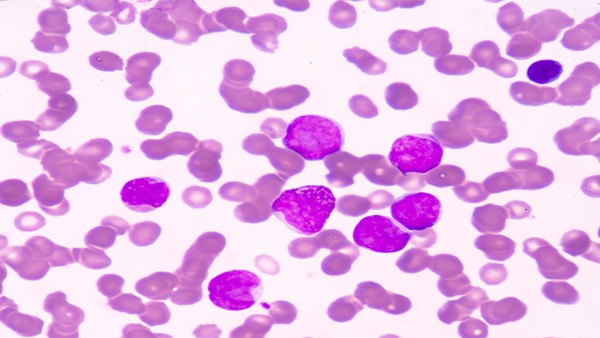 經(jīng)常抓頭皮會(huì)得皮膚癌嗎