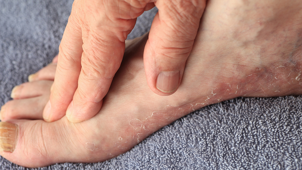 腦血栓和腦梗塞什么區(qū)別