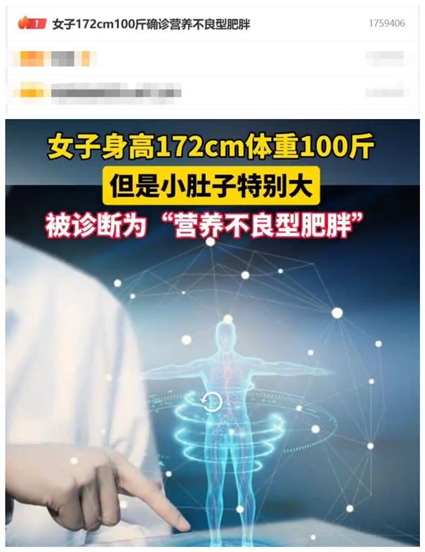 熱搜第一！女子172cm100斤確診營(yíng)養(yǎng)不良型肥胖