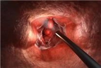 這種體檢項(xiàng)目40歲以上的人都要做！不然發(fā)現(xiàn)就是中晚期